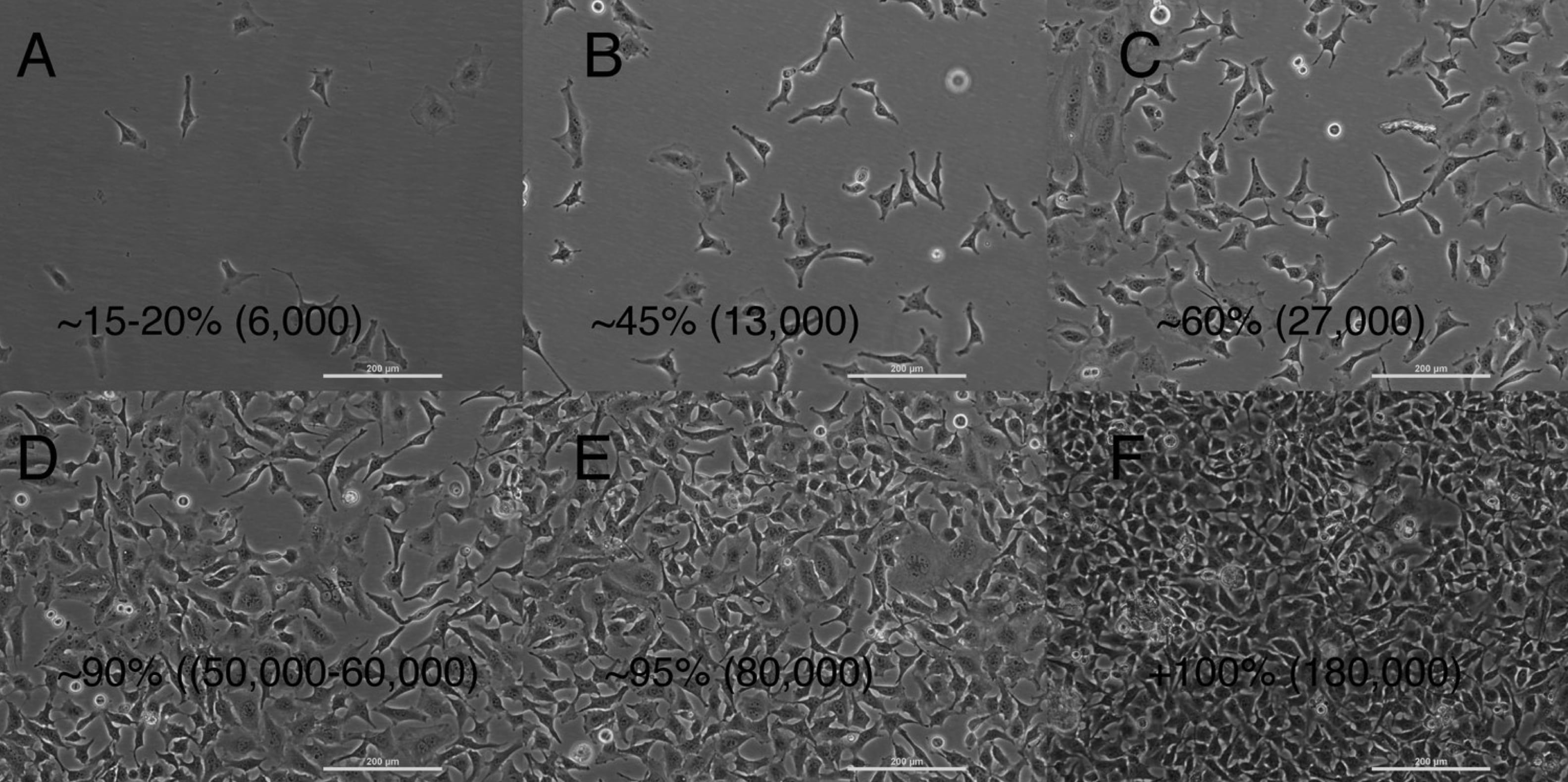 upotus-mahdollisuus-yst-vyys-kaivaa-leipoa-kristillinen-cell-culture